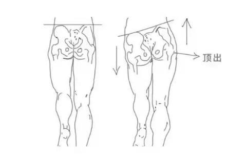 为了可爱,长期内八走路的,又或者动漫类型的"鸭子坐",导致大腿内侧