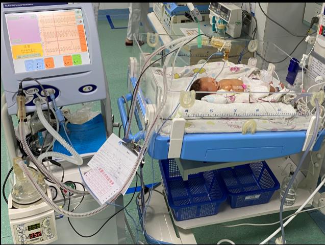 龙华区中心医院新生儿科成功救治一名患气胸新生儿
