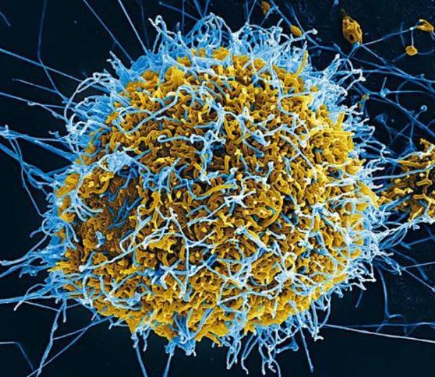"尼帕病毒"比"新冠病毒"更加危险,国外已经出现病例.